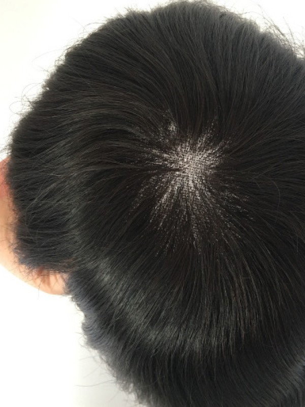 Französische Spitze Mit 5.1 Cm PU Rückseite Und  Seiten Doppellagige Spitzenfront Herrenhaar Perückensysteme